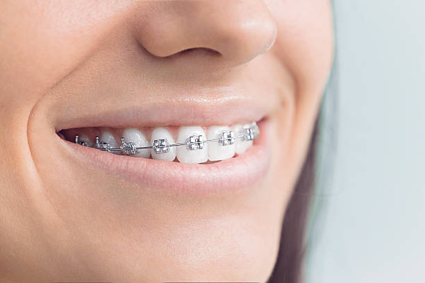 Why Choose Us for Your Dental Needs in Hayfield, VA